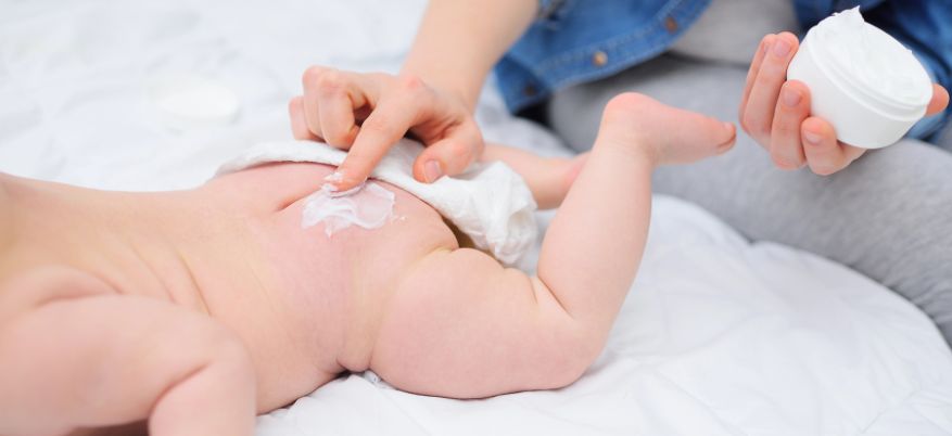 Crema all’ossido di zinco: cos’è e a cosa serve