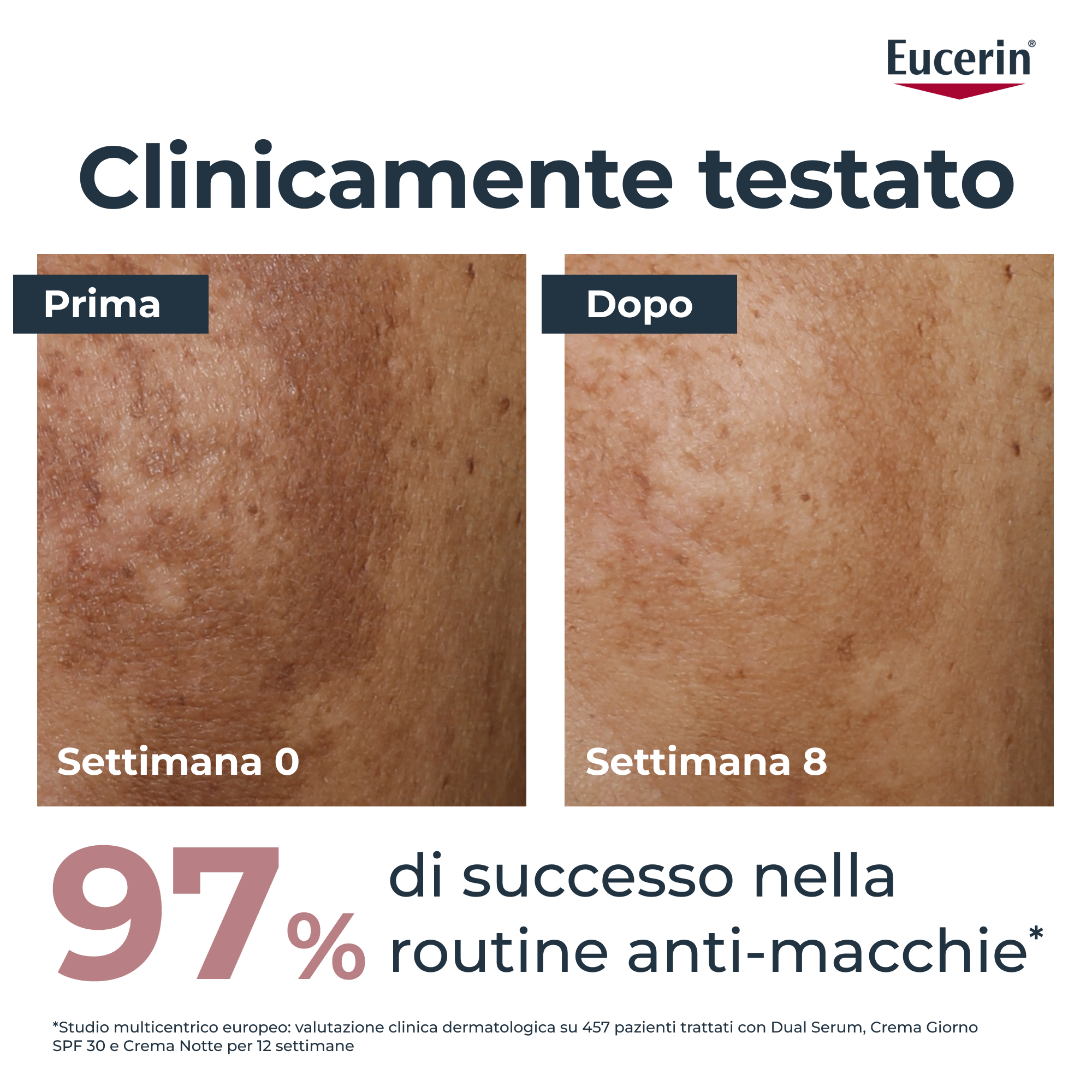 EUCERIN ANTI-PIGMENT Crema giorno anti-macchie con SPF 30