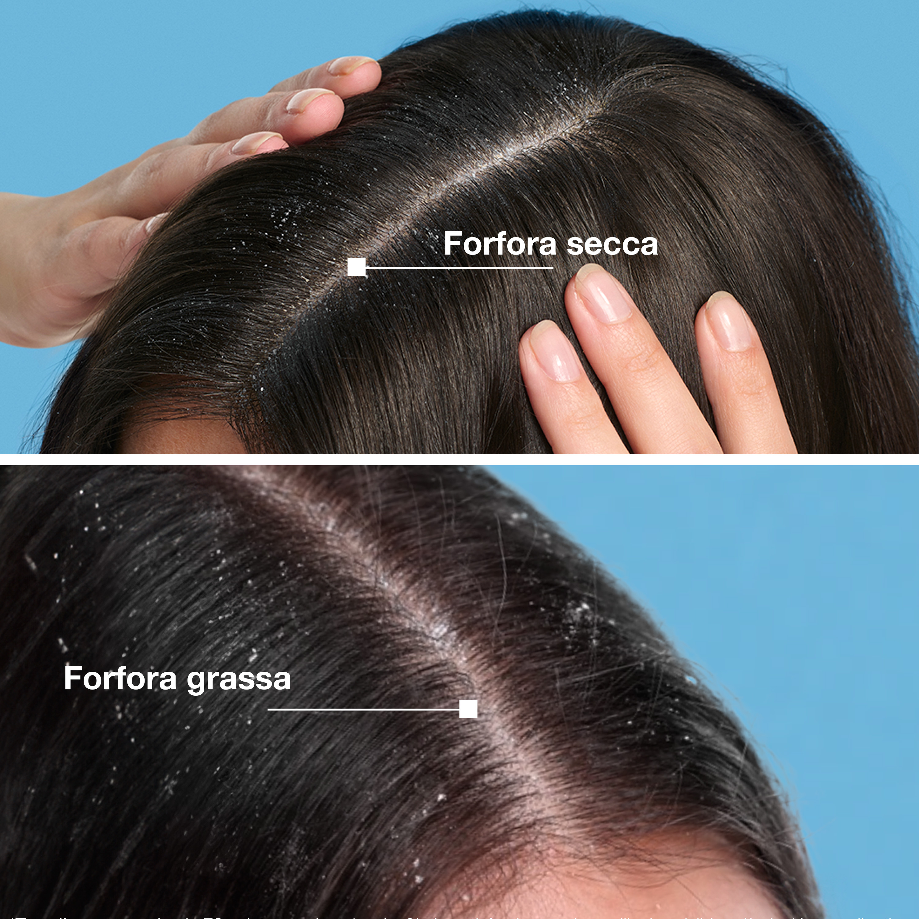 Ducray Kelual Squanorm Fresh Control Lozione, Elimina la Forfora e Lenisce la Sensazione di Prurito, 200ml 