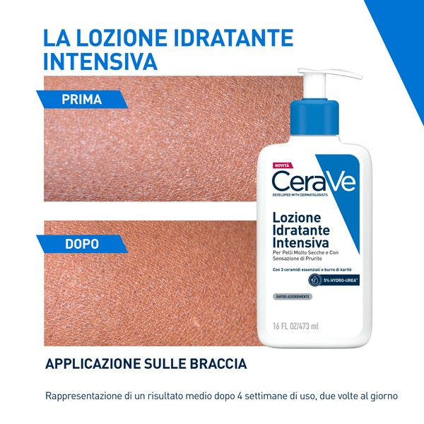 CeraVe Lozione Idratante Intensiva per Pelle Secca e Molto Secca con Sensazione di Prurito, con Hydro-Urea e Burro di Karité, idrata intensamente la pelle e da sollievo immediato alla sensazione di prurito, 473 ml