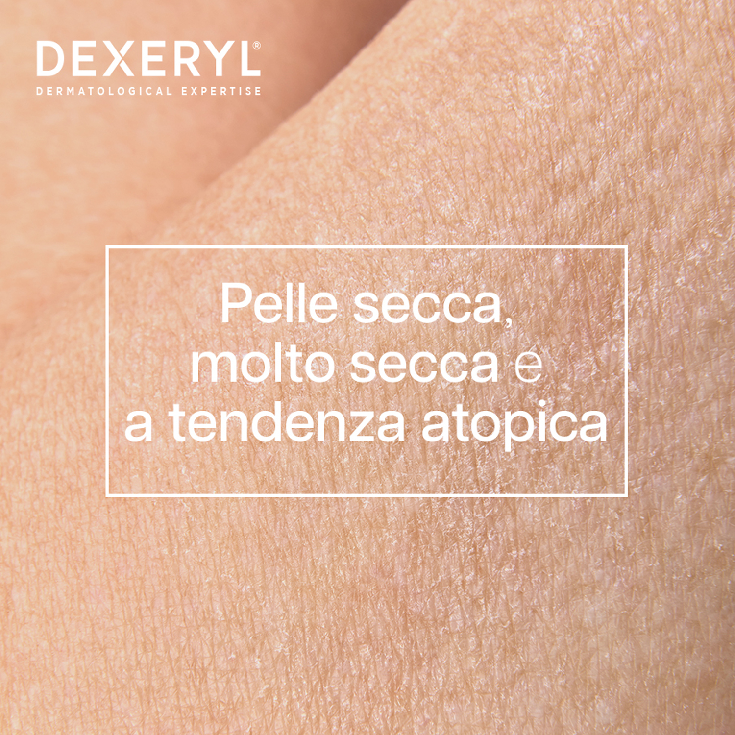 Dexeryl - Olio Lavante Antiprurito Per Pelle Secca E A Tendenza Atopica 200 ml