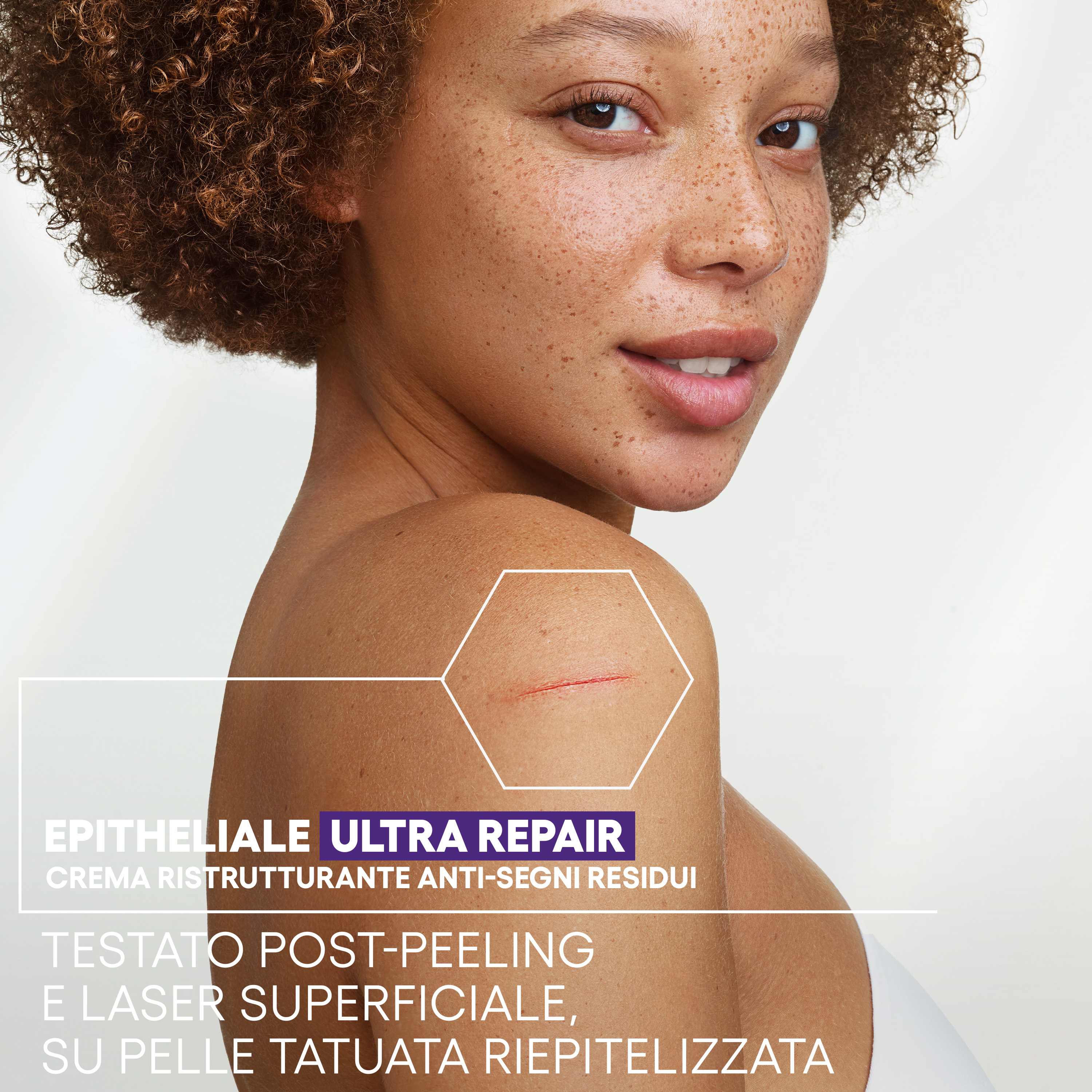A-Derma Epitheliale Ultra Repair Crema ristrutturante anti-segni residui riparazione cutanea, lesioni cutanee, post-peeling, post laser, acido ialuronico, 40 ml