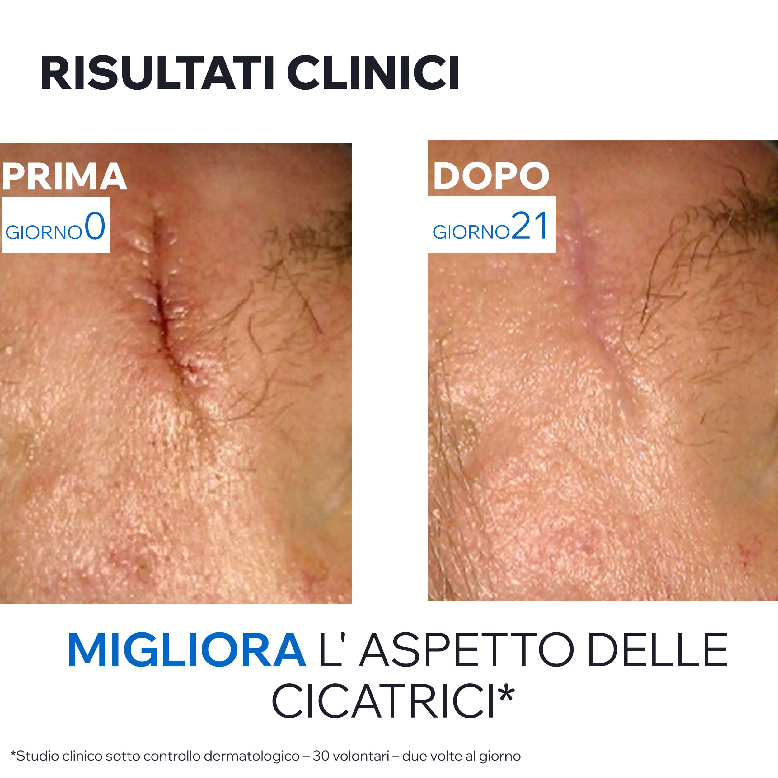 Uriage Bariéderm-Cica - Crema Riparatrice Lenitiva Viso E Corpo Per Pelle Irritata E Danneggiata 100 ml