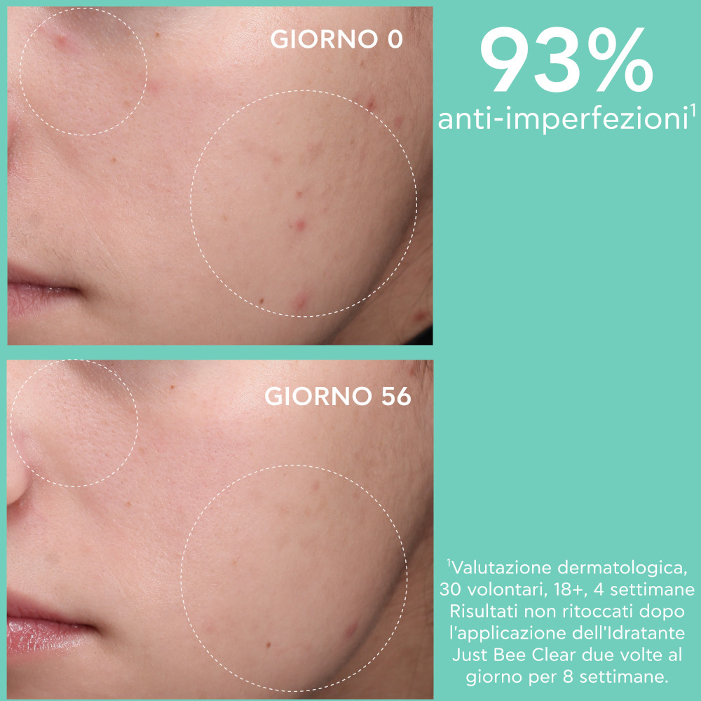 Apivita Just Bee Clear Crema Idratante Opacizzante Anti-Imperfezioni 