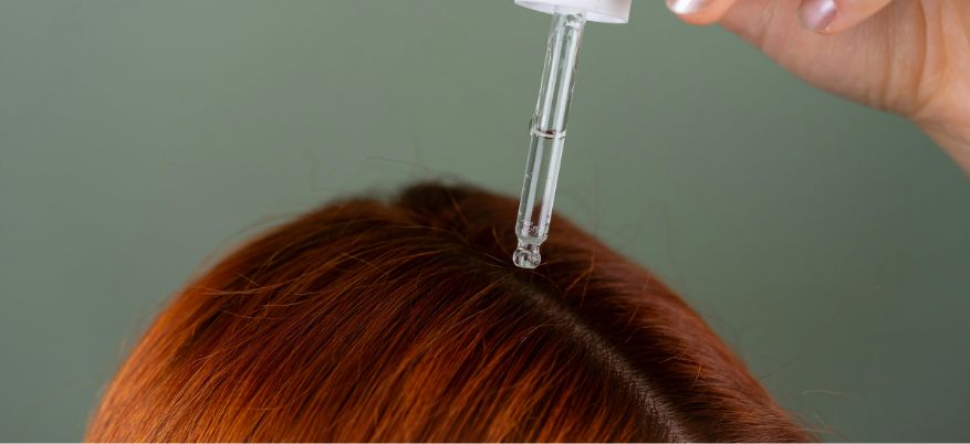 Dermatite del cuoio capelluto: cause, sintomi e rimedi