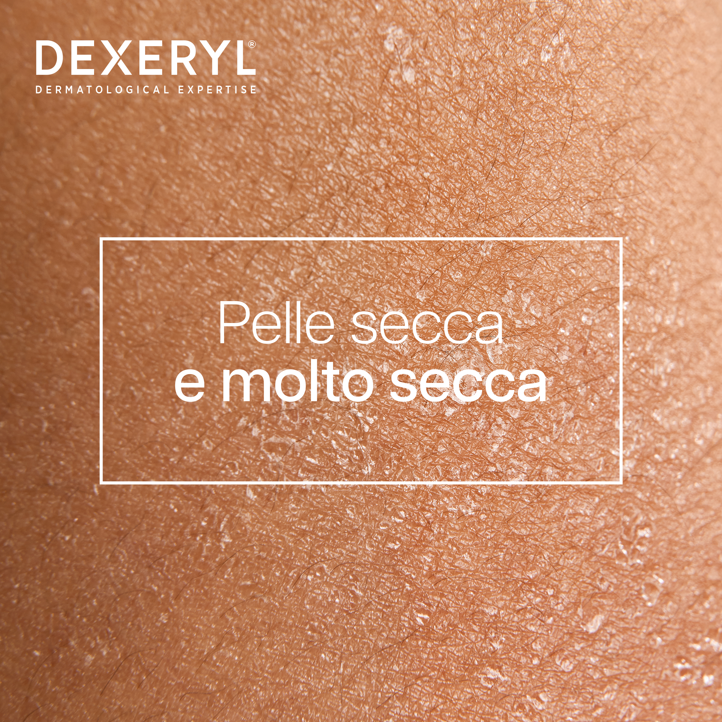 Dexeryl - Latte Nutritivo Per Pelle Secca E Molto Secca Di Viso E Corpo 500 ml