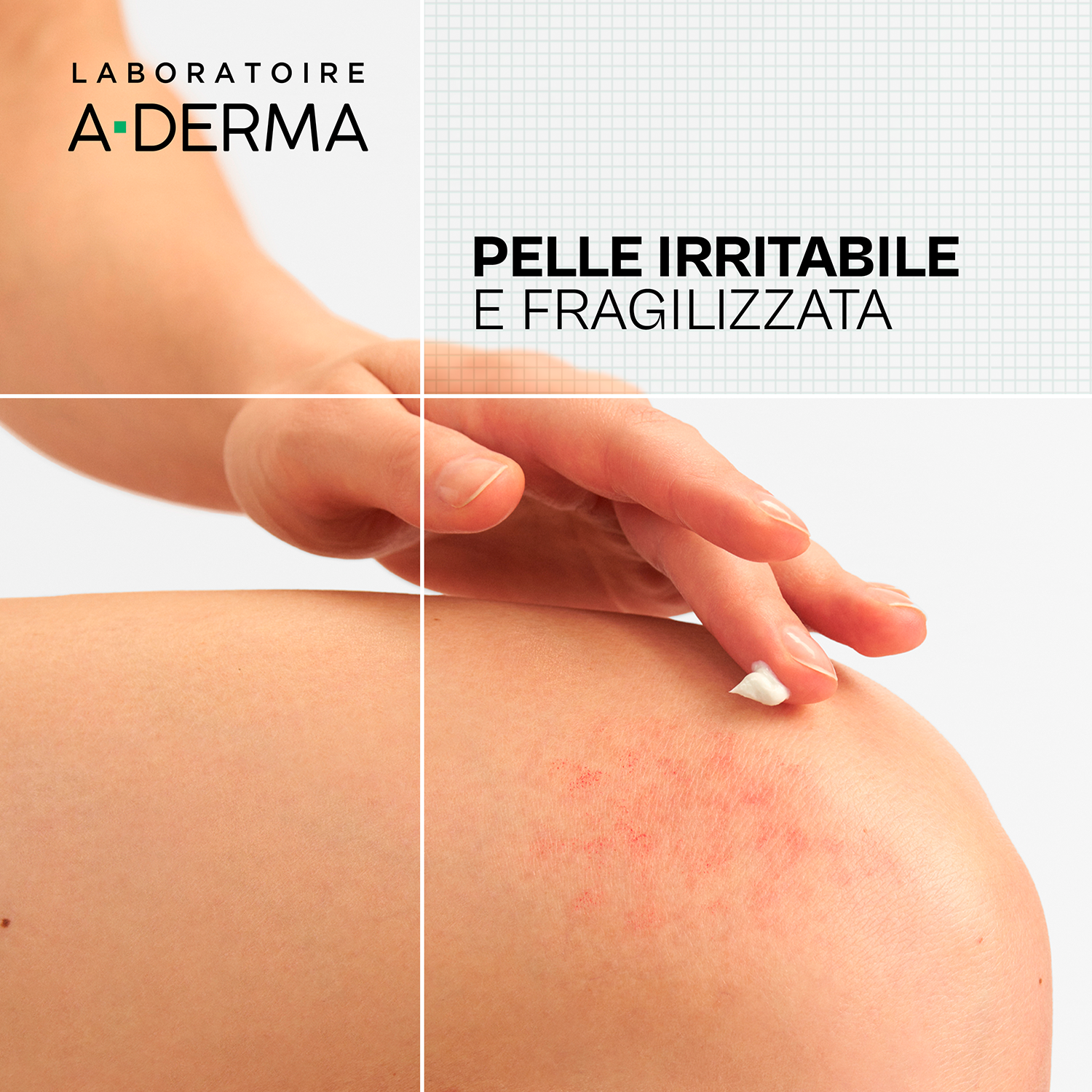 A-Derma Dermalibour+ - Cica Crema Ristrutturante Purificante Per Pelle Irritata E Fragile 100 ml