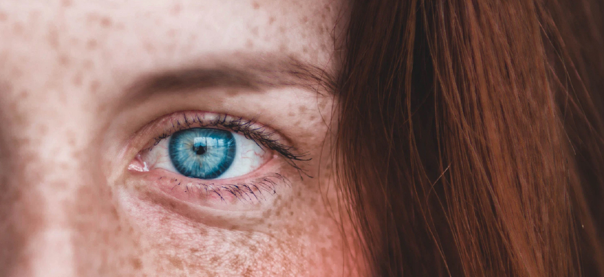 Secchezza oculare in estate: ecco cosa fare