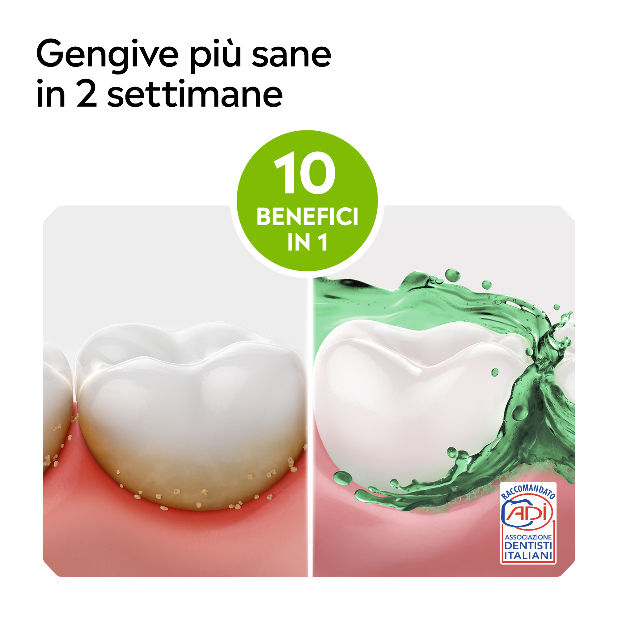 LISTERINE Difesa Denti Gengive Collutorio al Gusto Delicato alla Menta Delicata senza alcool 500 ml