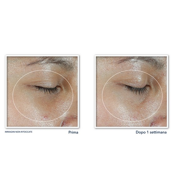 Multi Correxion Revive + Glow Eye Stick Balsamo revitalizzante per il contorno occhi 4gr