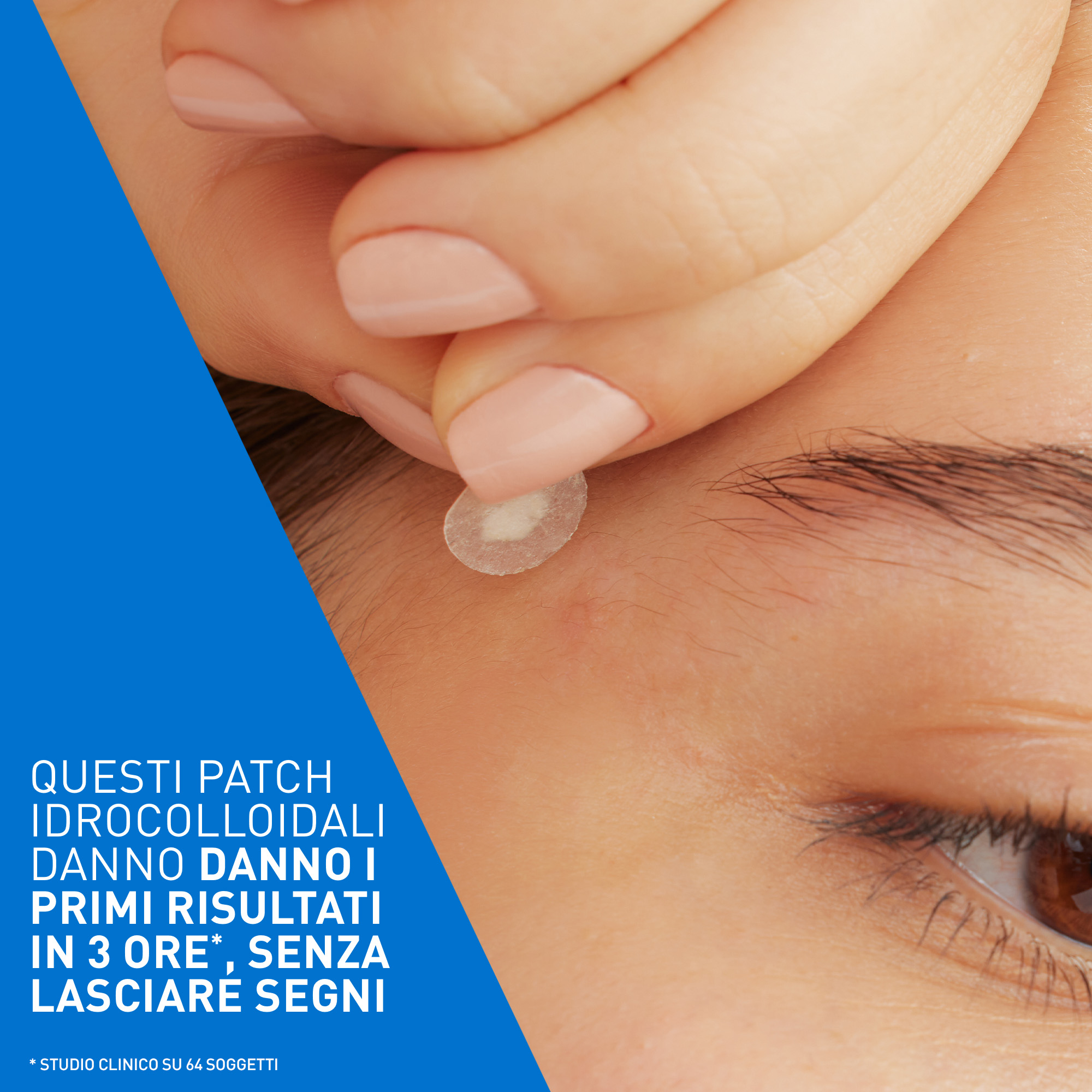 CeraVe Patches Idrocolloidali Anti Brufoli, Per Pelli a Tendenza Acneica, Trasparenti e Invisibili sulla Pelle, Non lascia segni, Con Niacinamide e 3 Ceramidi Essenziali, 22 Pezzi