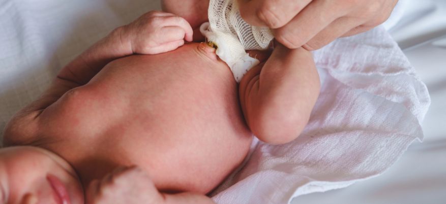 Pulizia del cordone ombelicale: come farla in modo corretto e sicuro