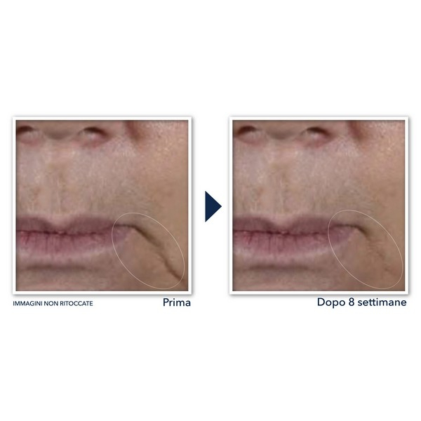 ROC Multi Correxion® Firm + Lift Crema Viso 50ml