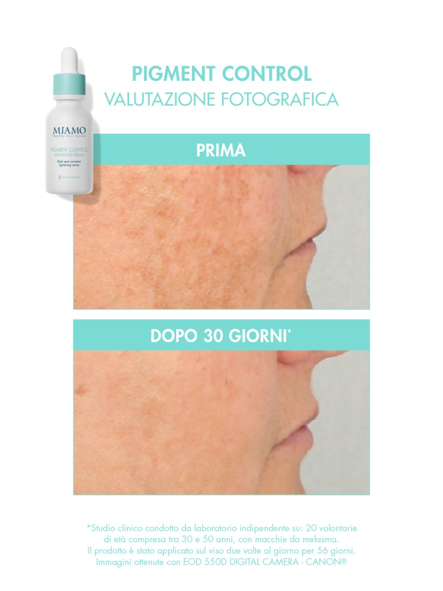 MIAMO Protocollo Macchie Della Pelle 