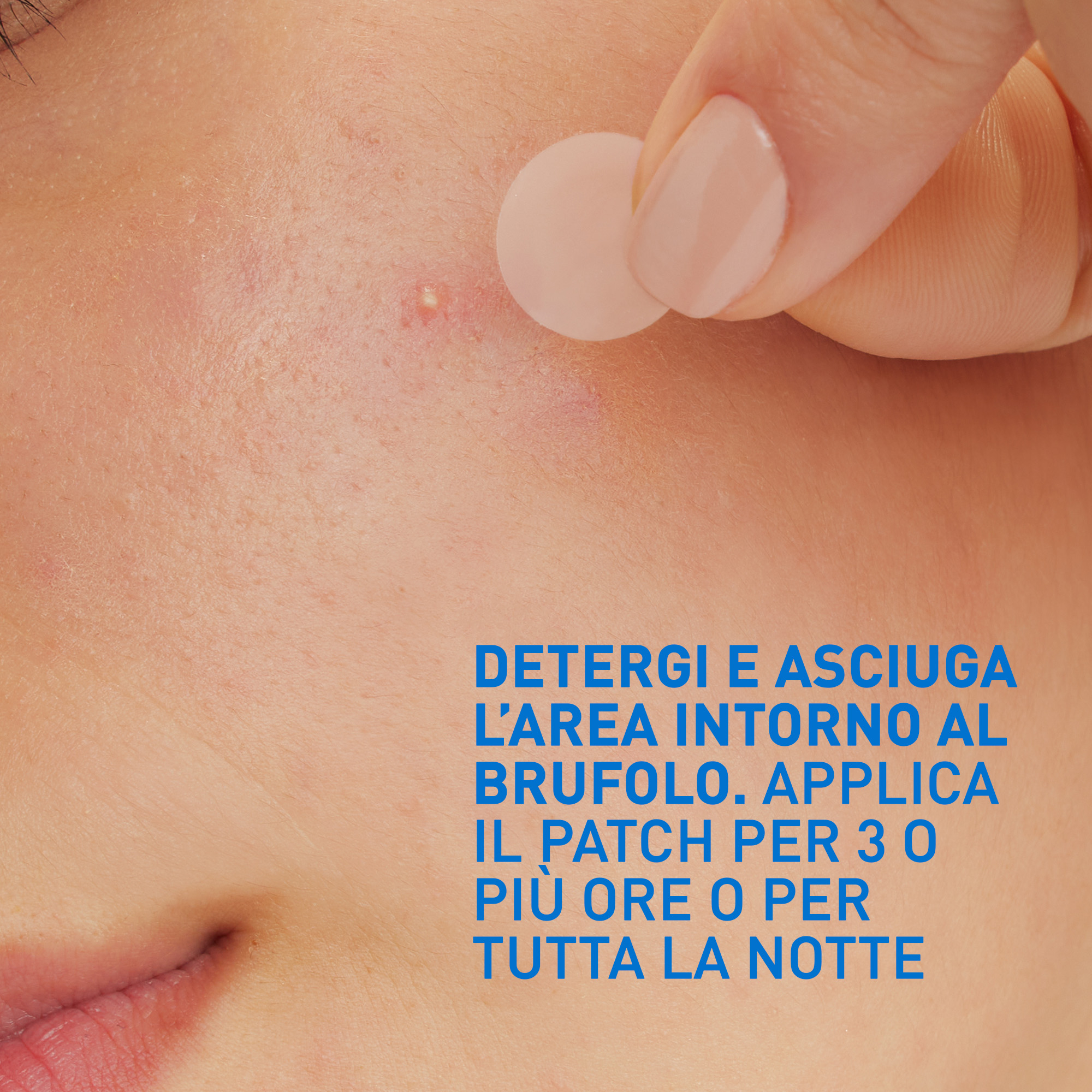 CeraVe Patches Idrocolloidali Anti Brufoli, Per Pelli a Tendenza Acneica, Trasparenti e Invisibili sulla Pelle, Non lascia segni, Con Niacinamide e 3 Ceramidi Essenziali, 22 Pezzi