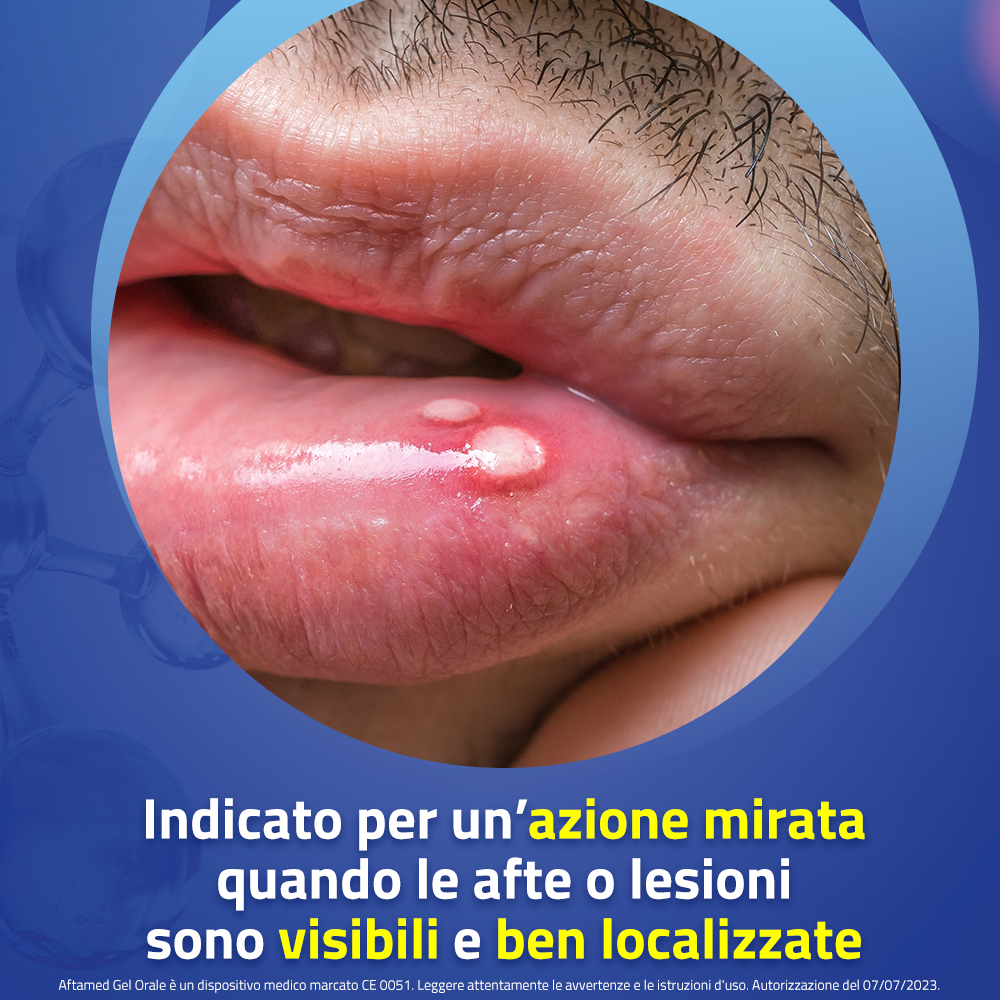 Aftamed Gel Orale Anti Afte 15 ml