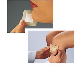 CURAPLAST SENSITIVE STR 8X10CM