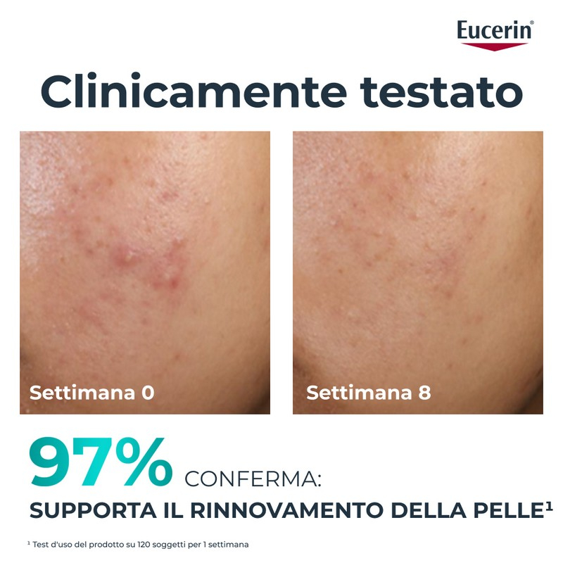 EUCERIN DC TRATTAMENTO RINN