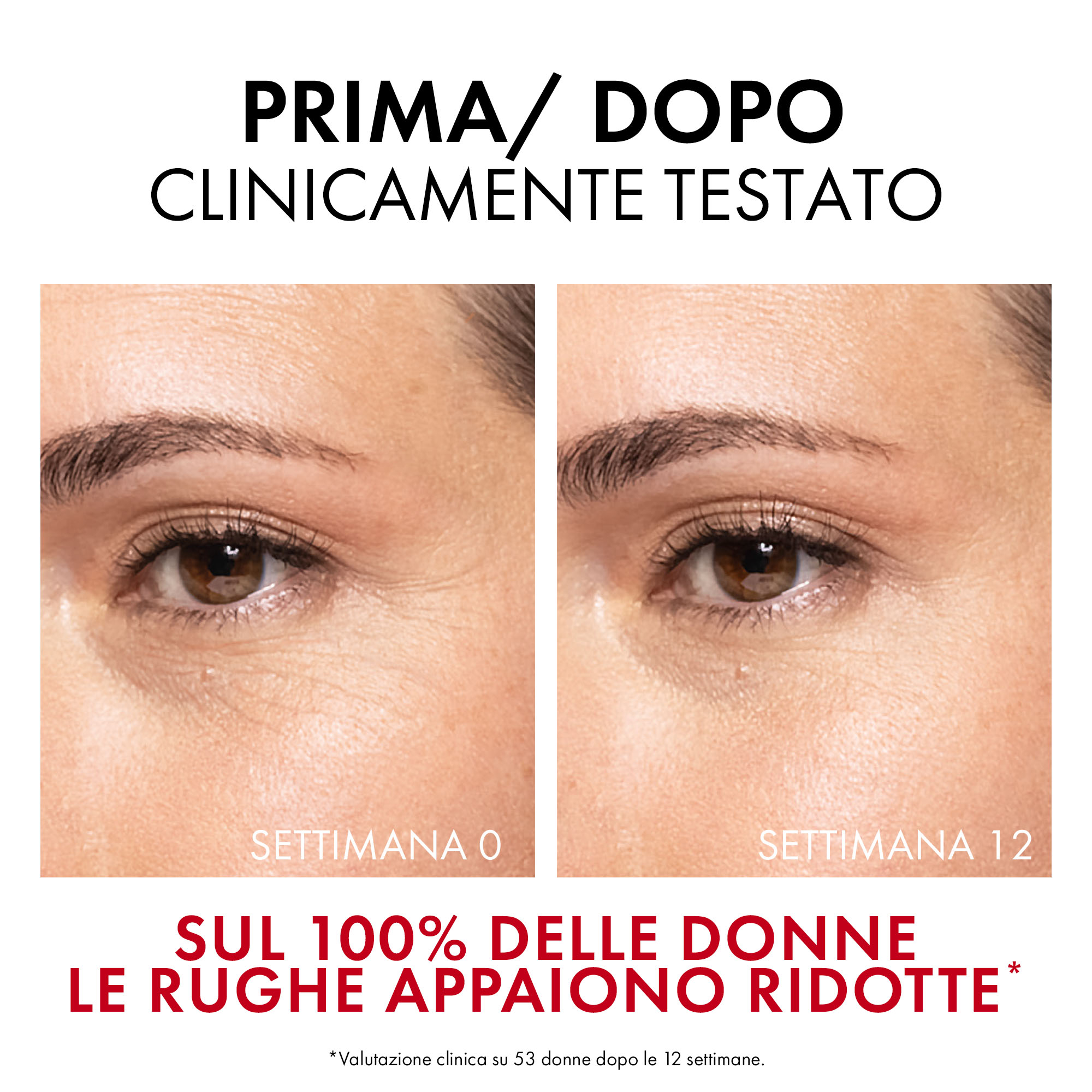 Vichy Liftactiv Collagen Specialist 16 Siero: Corregge 16 segni dell'età** - 30ml