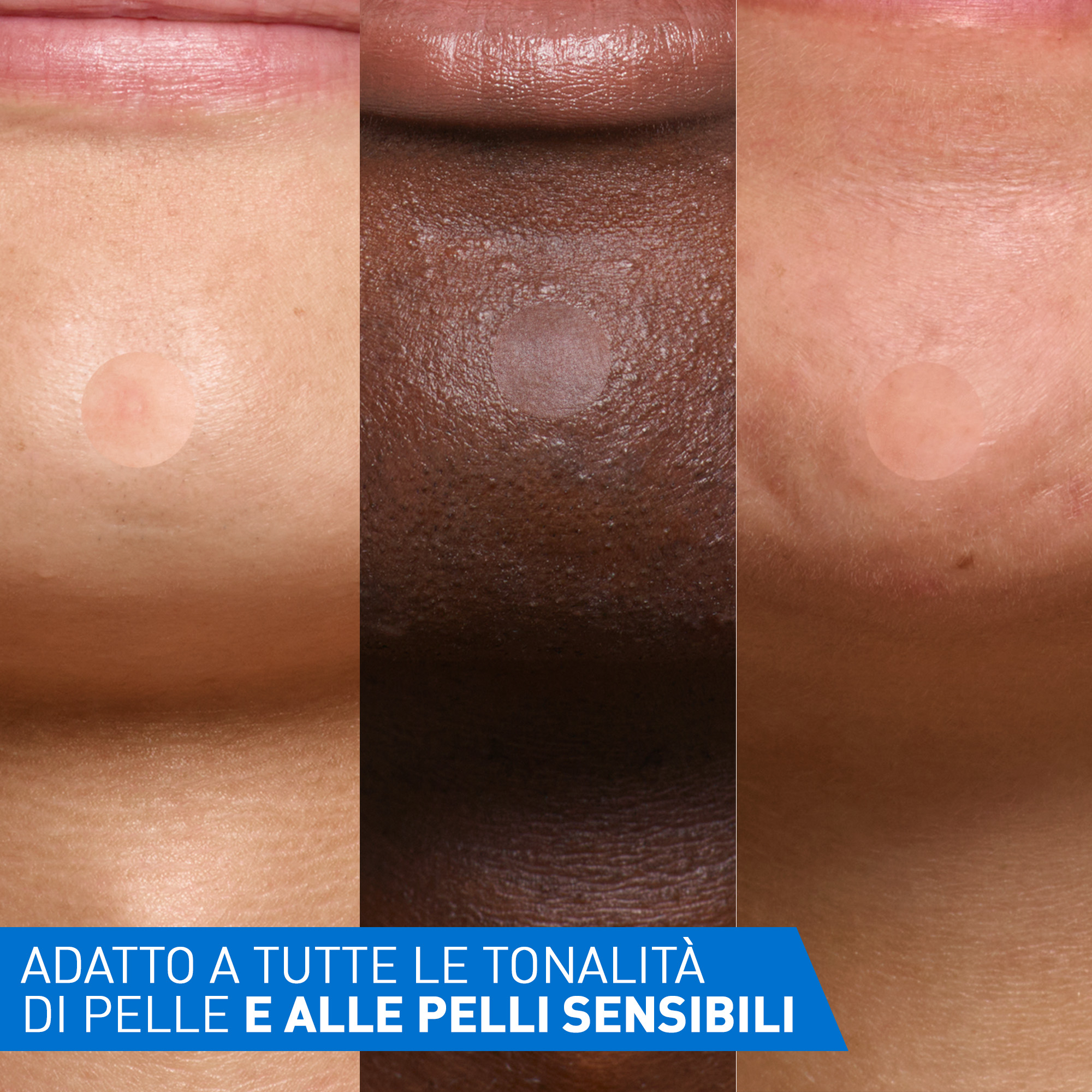 CeraVe Patches Idrocolloidali Anti Brufoli, Per Pelli a Tendenza Acneica, Trasparenti e Invisibili sulla Pelle, Non lascia segni, Con Niacinamide e 3 Ceramidi Essenziali, 22 Pezzi