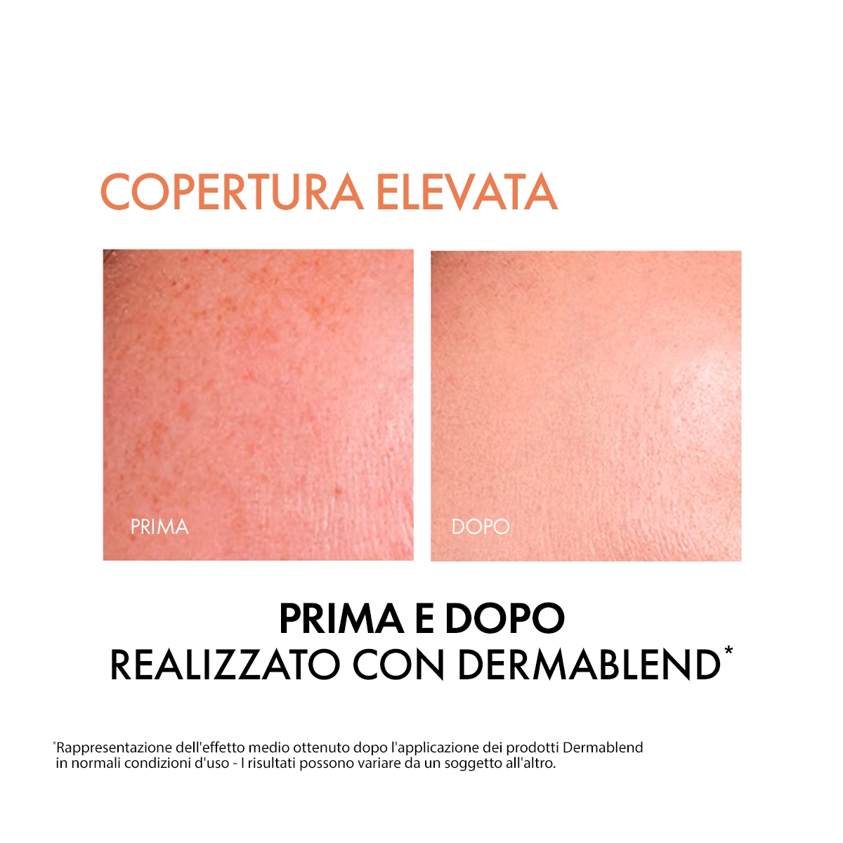 Vichy Dermablend Fondotinta Correttore Fluido 16h tonalità 30 - 30 ml correttore fino a 16 ore