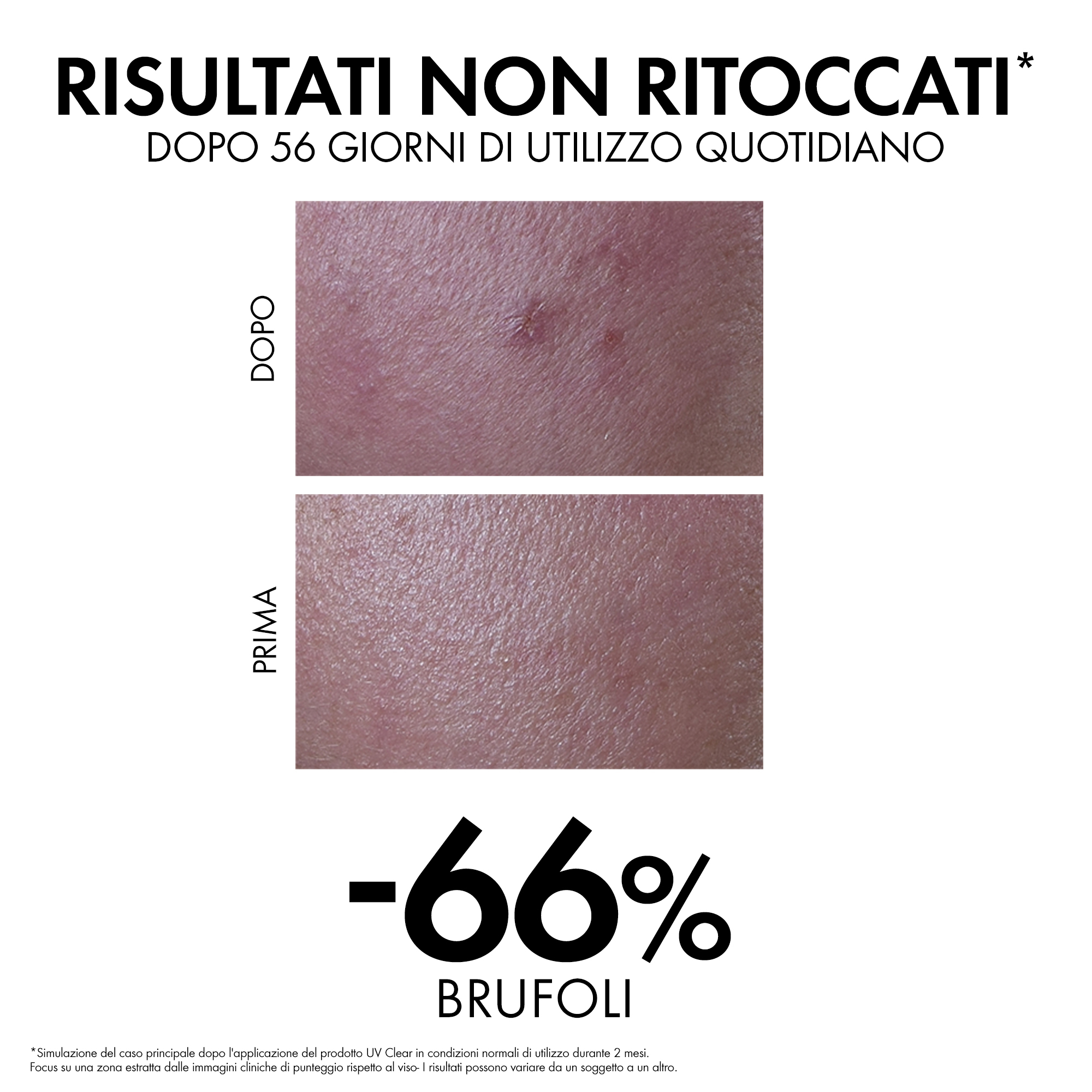 Vichy Capital Soleil UV-Clear SPF50+ - Fluido Anti-Imperfezioni per il viso 40 ml