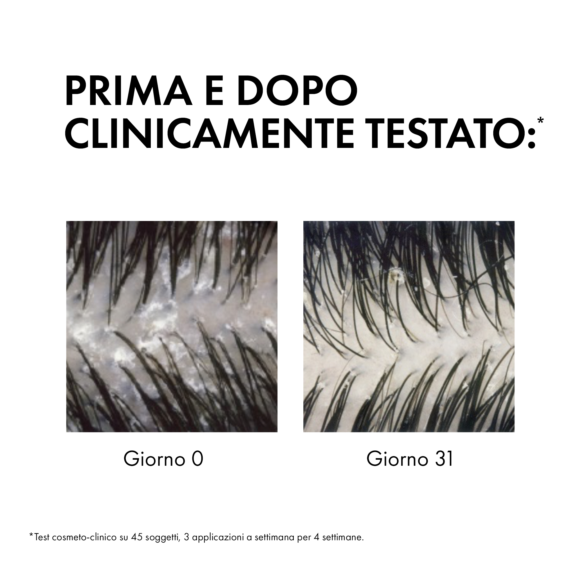 Vichy Dercos Shampoo trattante Anti-forfora DS per capelli da normali a grassi 400 ml