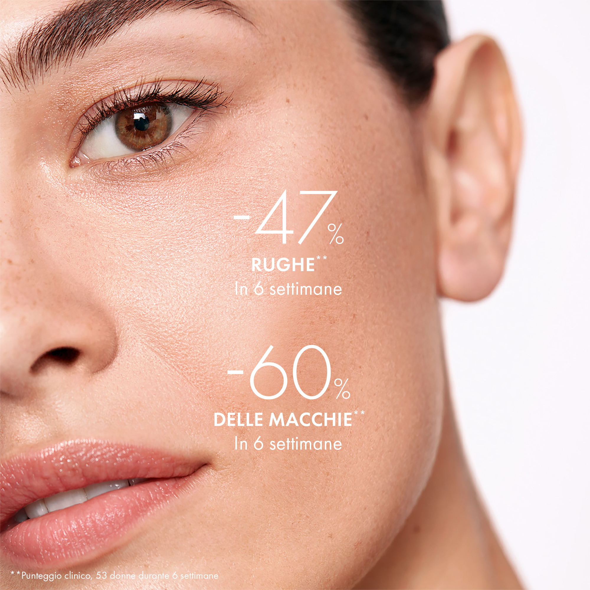 Liftactiv Supreme Siero HA Epidermic Filler con 1,5% di Acido Ialuronico Puro 30 ml