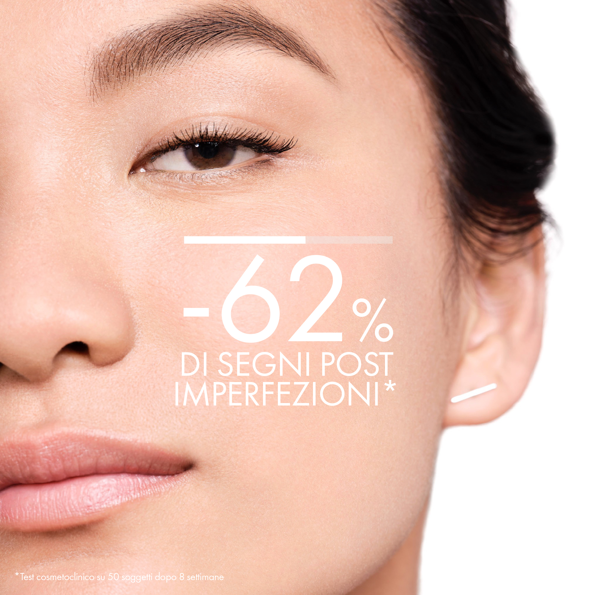 Vichy Normaderm Trattamento Idratante Doppia Azione per pelle a tendenza acneica 50 ml