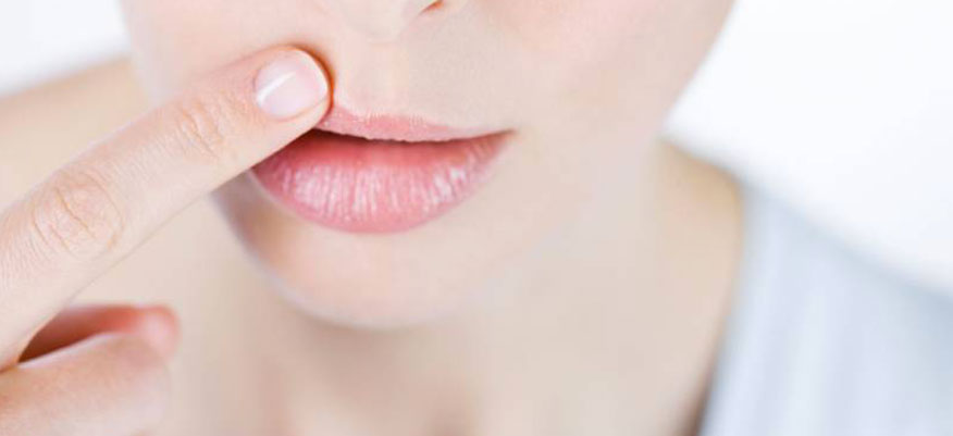 Rimedi naturali per le labbra screpolate