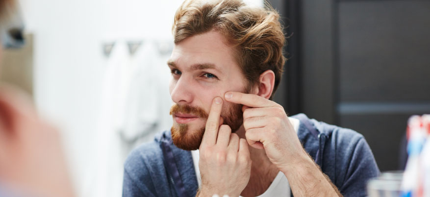 Rimedi per i brufoli: ecco come eliminarli velocemente