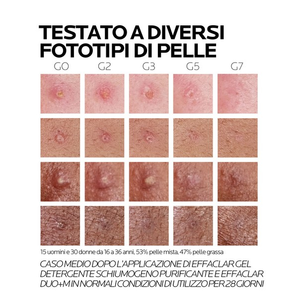 La Roche-Posay Effaclar Duo+M Trattamento Viso Anti-imperfezioni per pelle mista, grassa o a tendenza acneica 40 ml