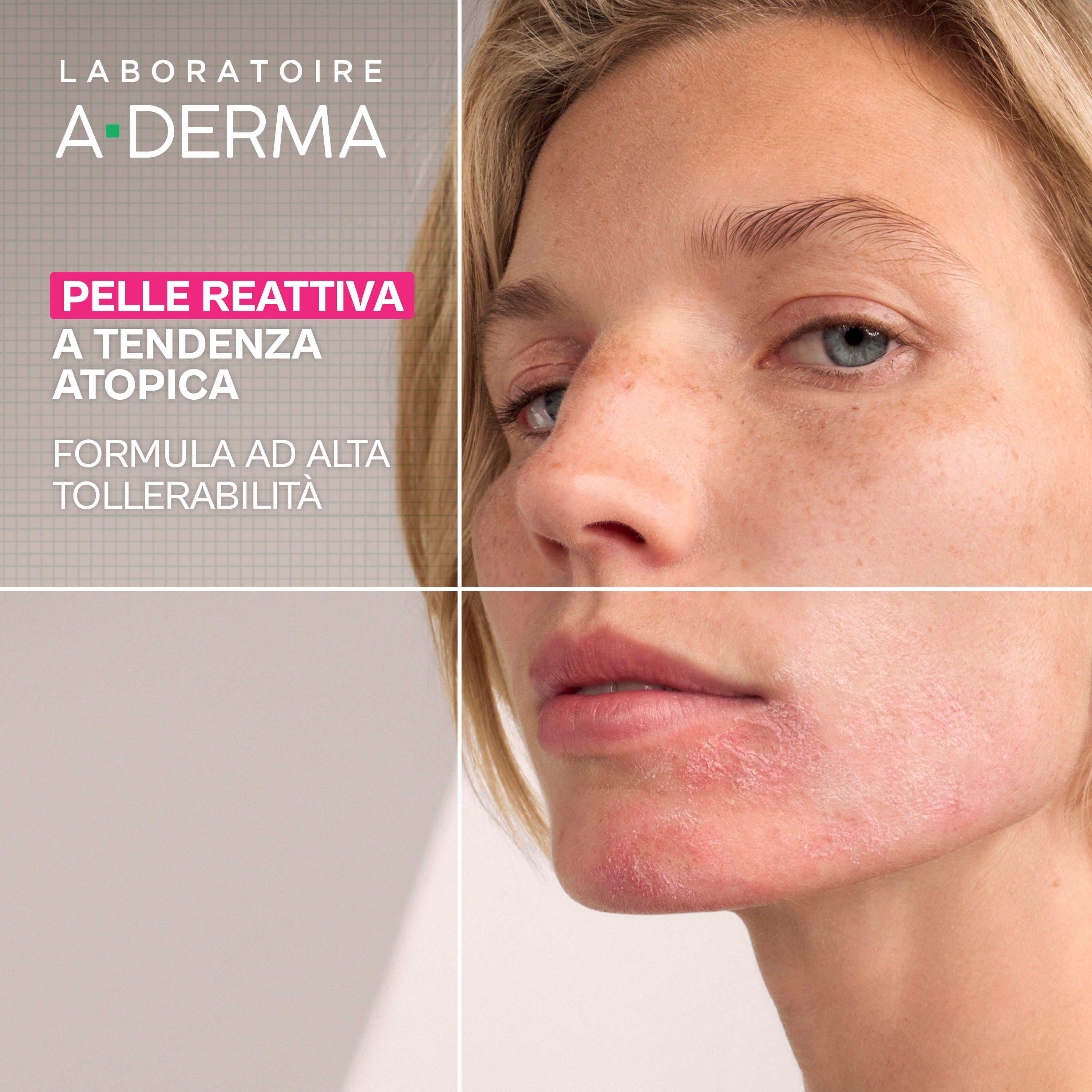 A-Derma Exomega - Gel Detergente Lenitivo Per Pelle A Tendenza Acneica 200 ml