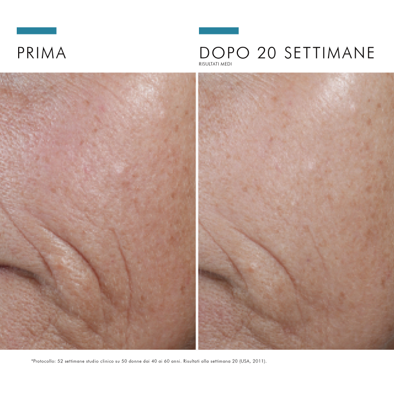 SkinCeuticals C E Ferulic Siero viso antiossidante con Vitamina C ed E in forma pura 30 ml