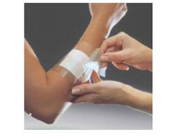 OPSITE FLEXIFIX 15X1000 1MED