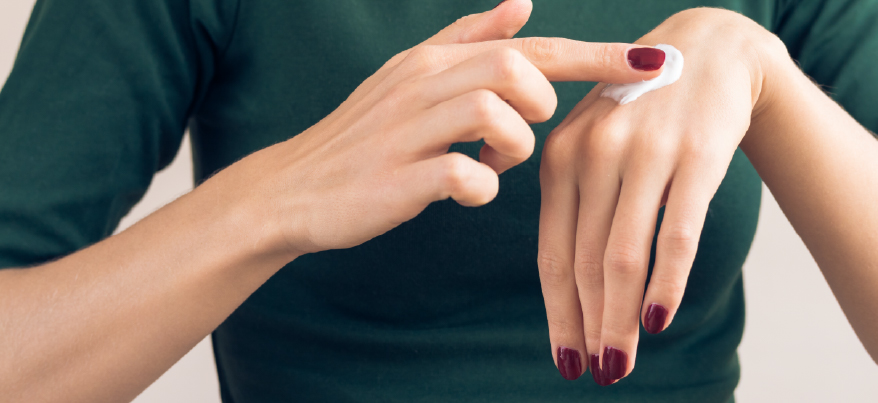 Dermatite da freddo: come riconoscerla e trattarla