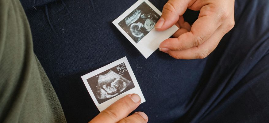 Come calcolare le settimane di gravidanza con precisione